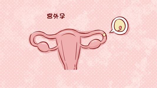 兴义女性孕早期出血的原因可能是因为宫外孕