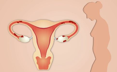 兴义妇女内分泌性不孕需要注意哪些问题