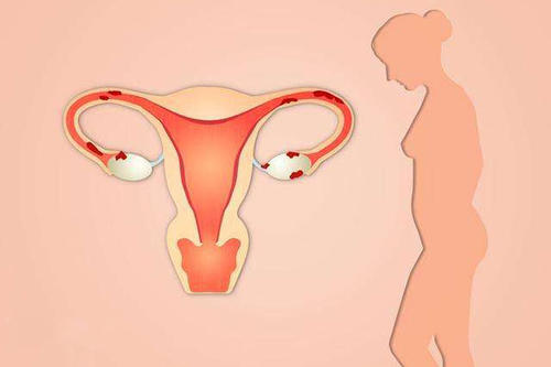 兴义妇女宫颈炎的病因都有什么